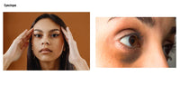 Can eye makeup cause dark circles? Debunking the myth