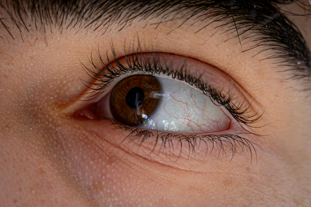 Sparse Lashes or Thinning Brows? Try This Night Serum