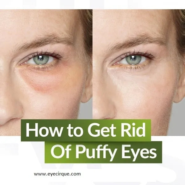 Get rid of those puffy eyes! Best eye Serum for puffy eyes – Eyecirque ...