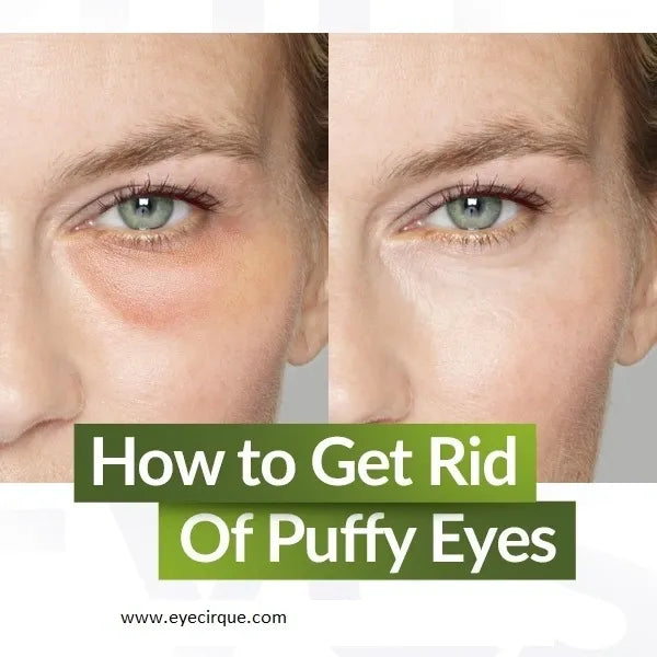 Get rid of those puffy eyes! Best eye Serum for puffy eyes