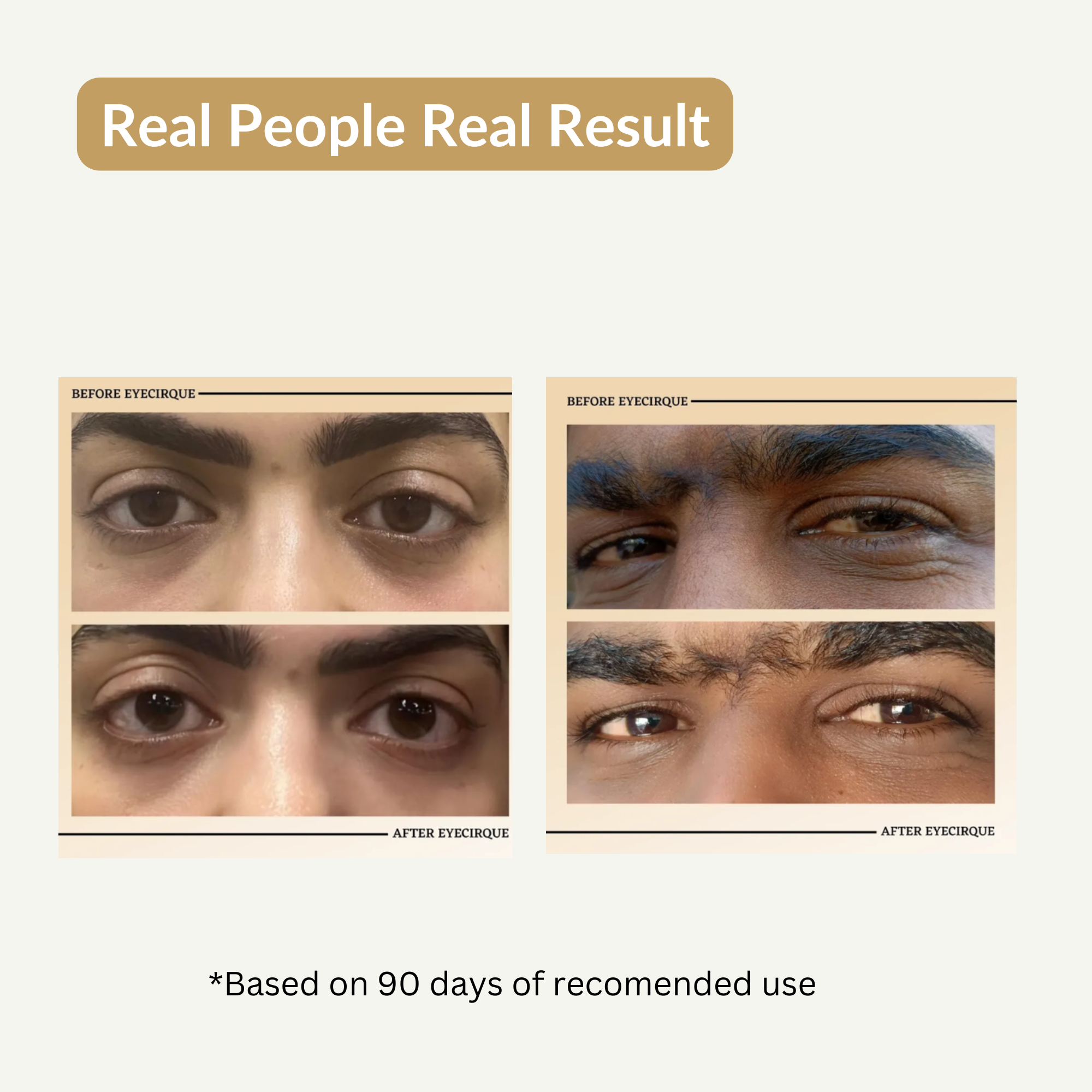 Coffee Under Eye Gel Serum for Dark Circles, Puffy Eyes, Eye Bags & Wrinkles