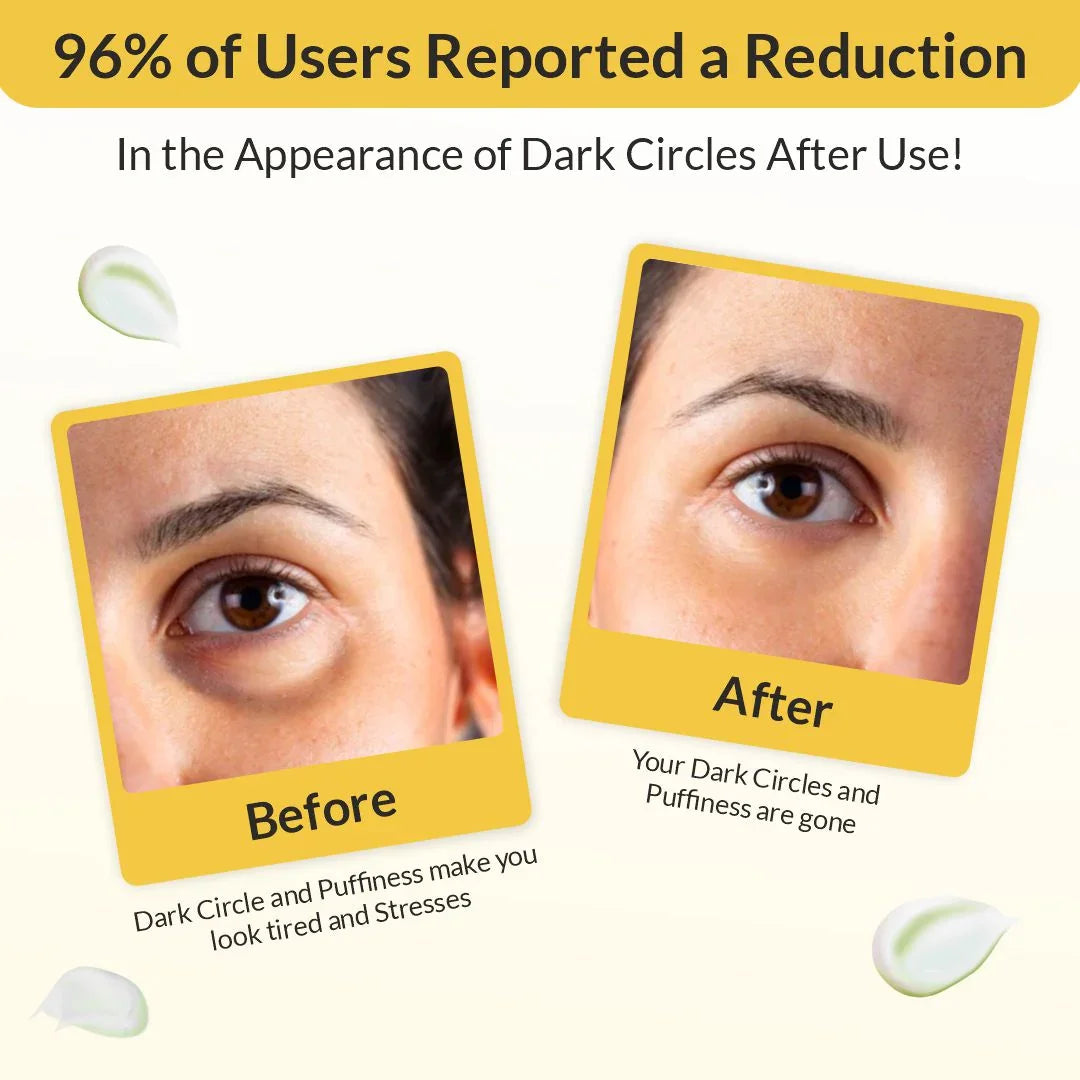 Eyecirque Under Eye Gel Serum for Dark Circles, Puffiness & Eye Bags - Eyecirque Store