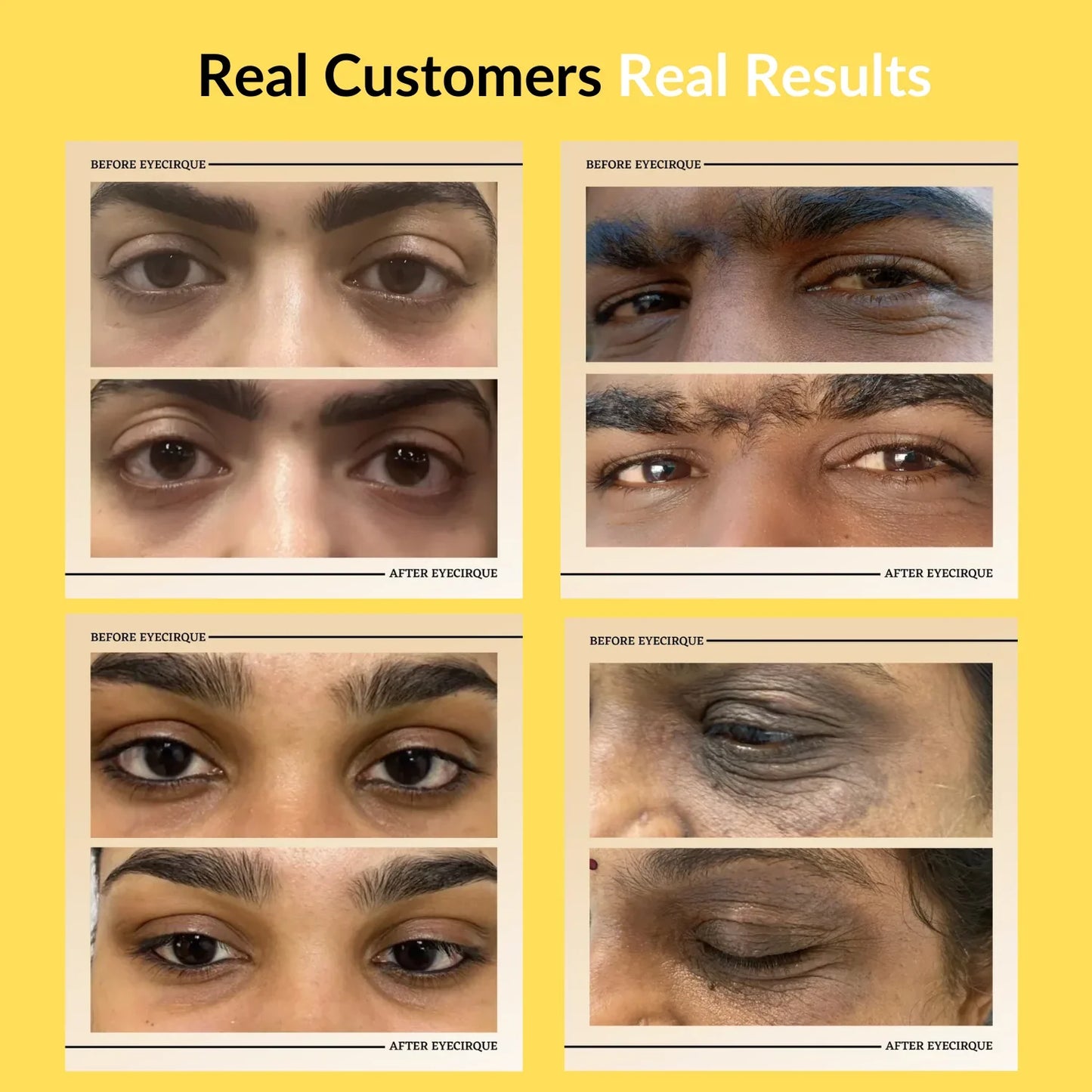 Eyecirque Under Eye Gel Serum for Dark Circles, Puffiness & Eye Bags - Eyecirque Store