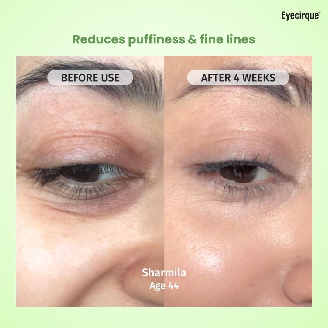 Eyecirque Eyelift Under Eye Gel Cream for Dark Circles, Puffy Eyes, Eye Bags & Wrinkles